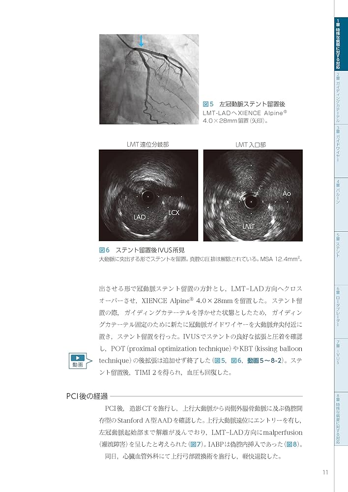 上級医を目指す循環器治療手技 PCI ─ 350本の動画を含む電子版